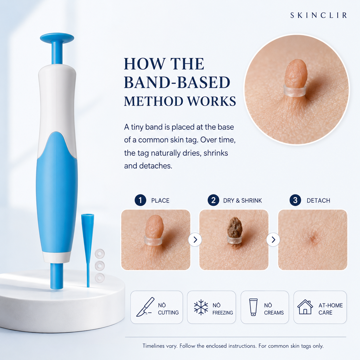 SKINCLIR | Skin Tag Removal Made Simple